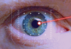 Chirurgie laser yeux prix